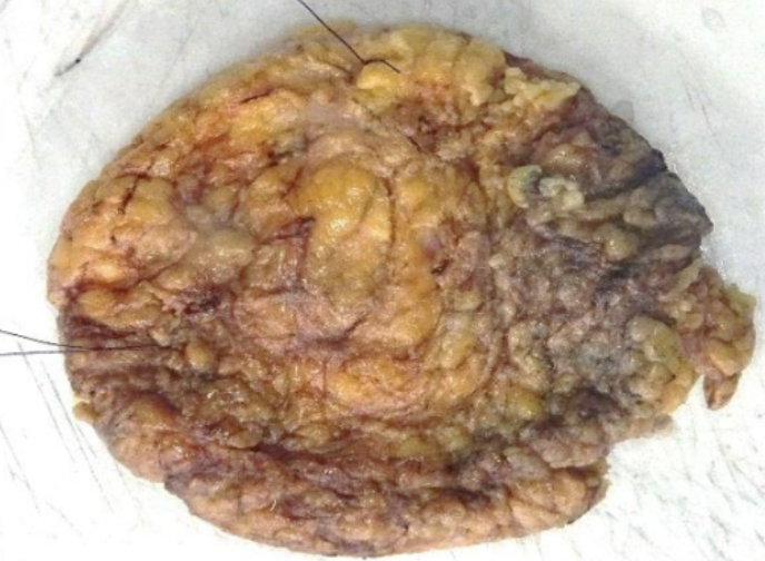 Description of the image
